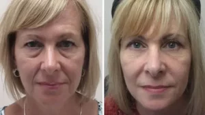 Janaina Fonseca / 59 anos