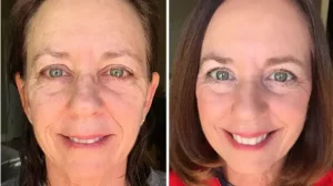 Edna Cardoso, 74 anos, Mato Grosso-MS.