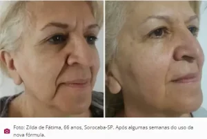 Antes e depois do Rosa Amazônica